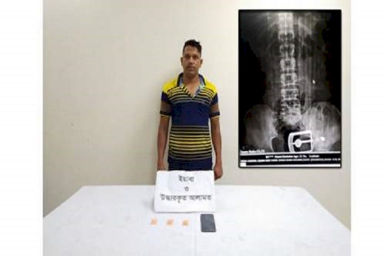 পেটের ভেতর ১২৯ পিস ইয়াবা!